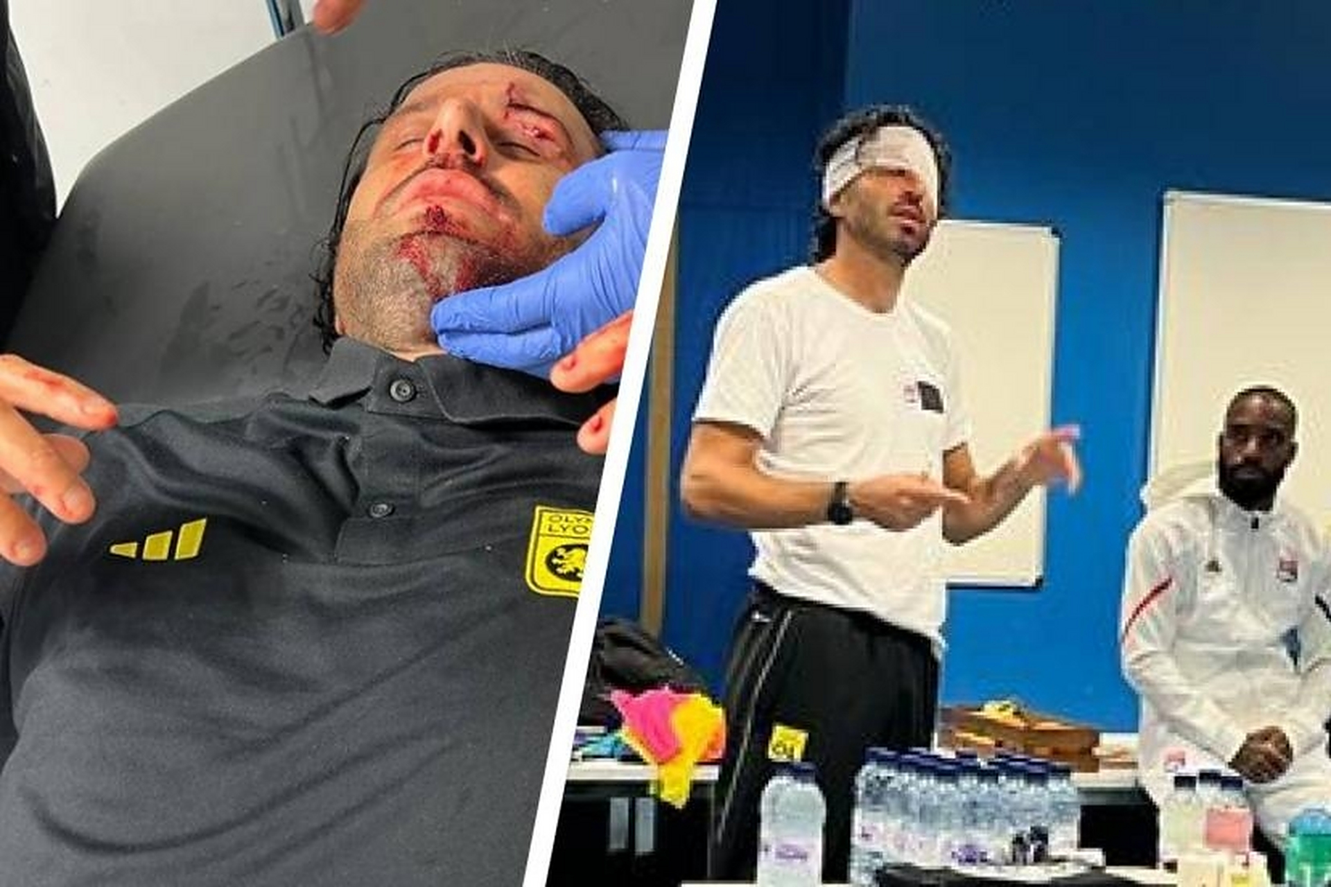 包含里昂球员因伤缺席下一场比赛的词条 包含里昂球员因伤缺席下一场比赛的词条